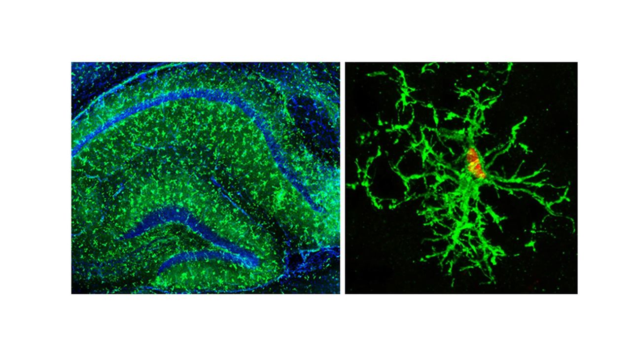 Human Brain Cells Grown in Mice Could Lead to Alzheimer's Therapy