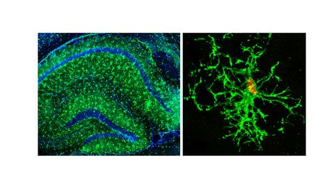 Human Brain Cells Grown in Mice Could Lead to Alzheimer's Therapy