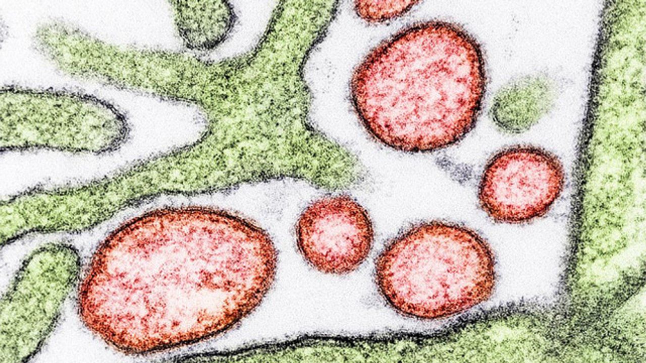 Nipah Virus Particles