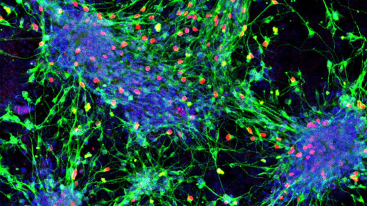 A Blueprint for Turning Stem Cells Into Sensory Interneurons