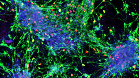 A Blueprint for Turning Stem Cells Into Sensory Interneurons