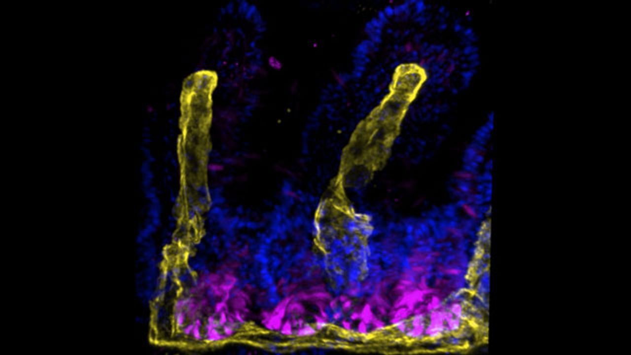 New Insights Into How the Intestine Replaces and Repairs Itself