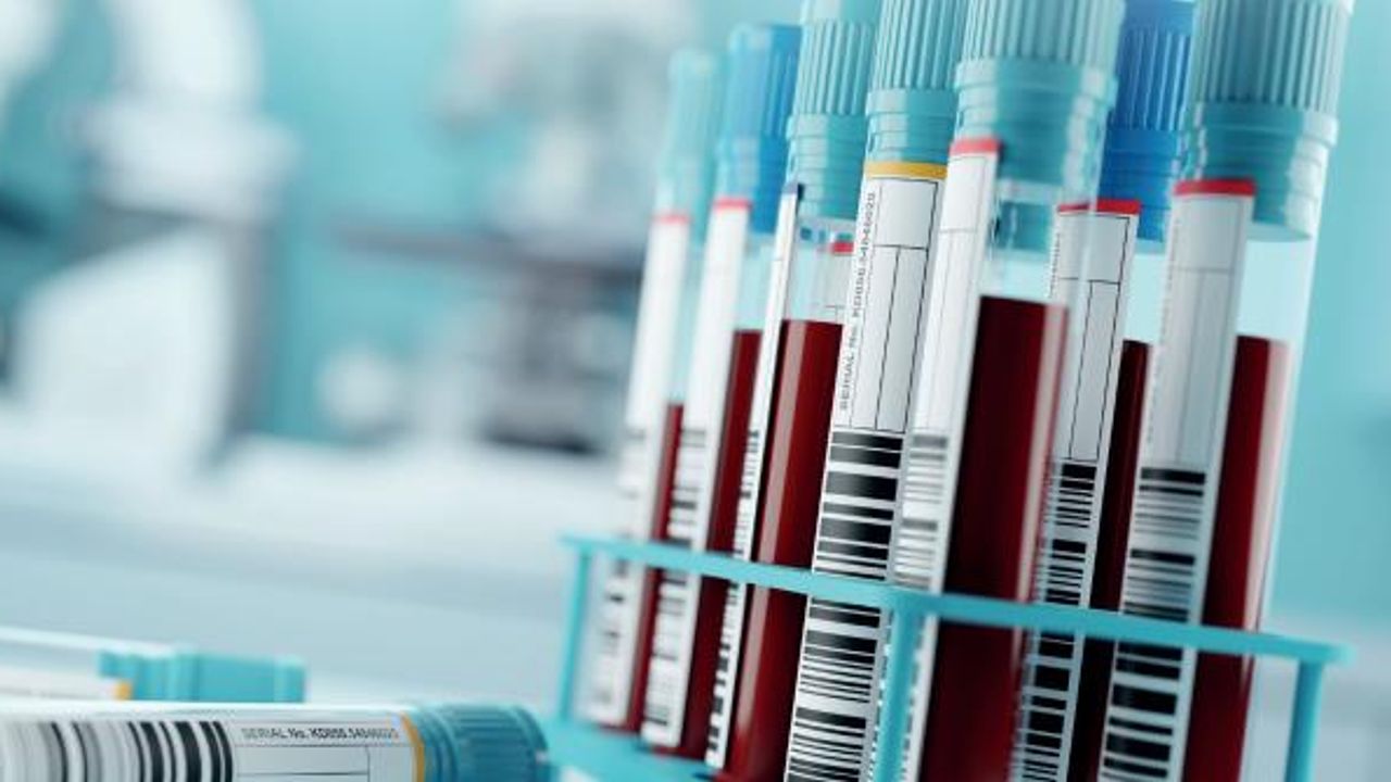 Development of a Targeted Plasma Quantitation Assay Using dia-PASEF