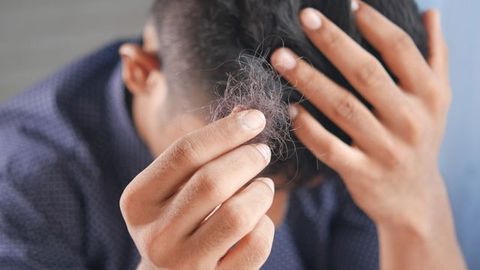 Hair Loss and Low Sex Drive Added to List of Long COVID Symptoms
