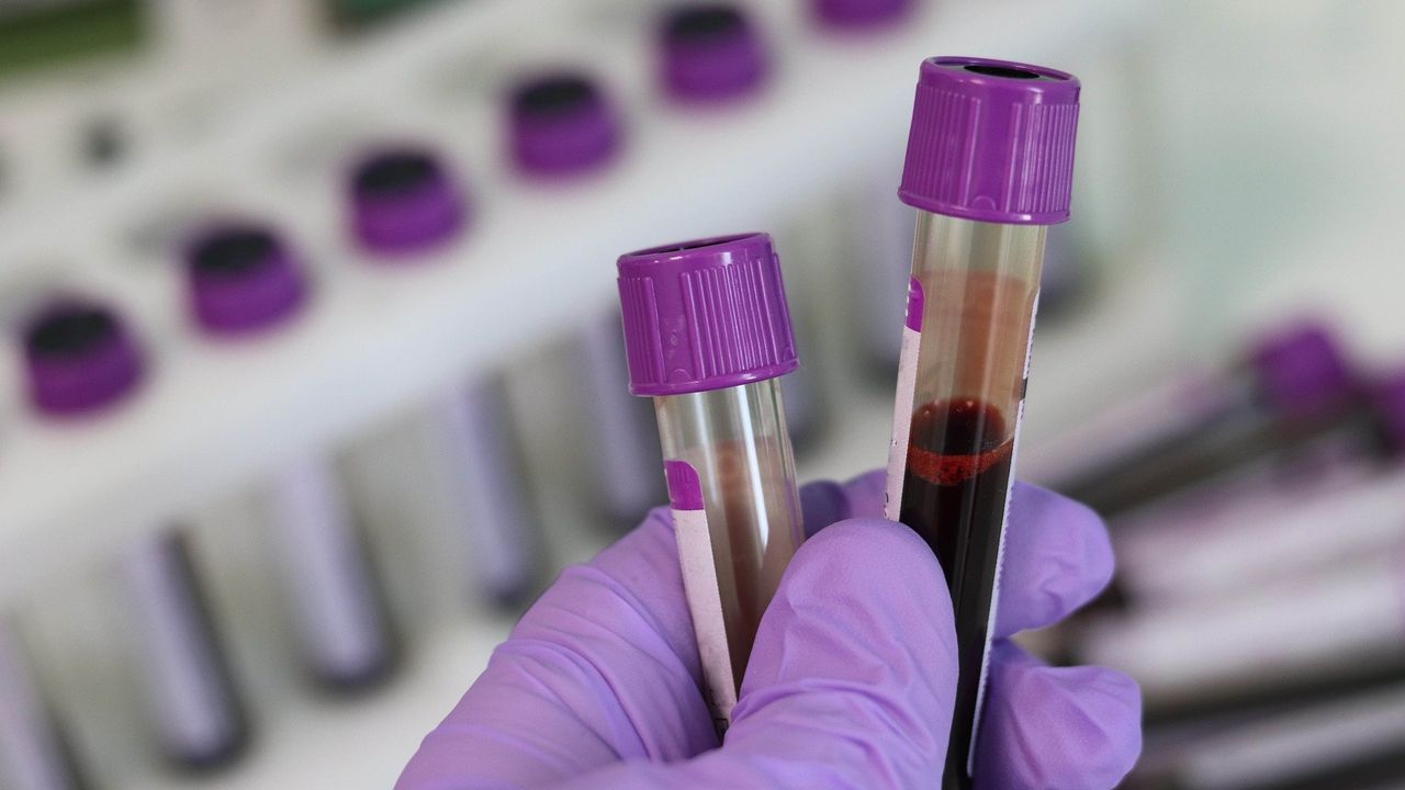 The Immune System Can Help Us To Diagnose Biliary Tract Cancer