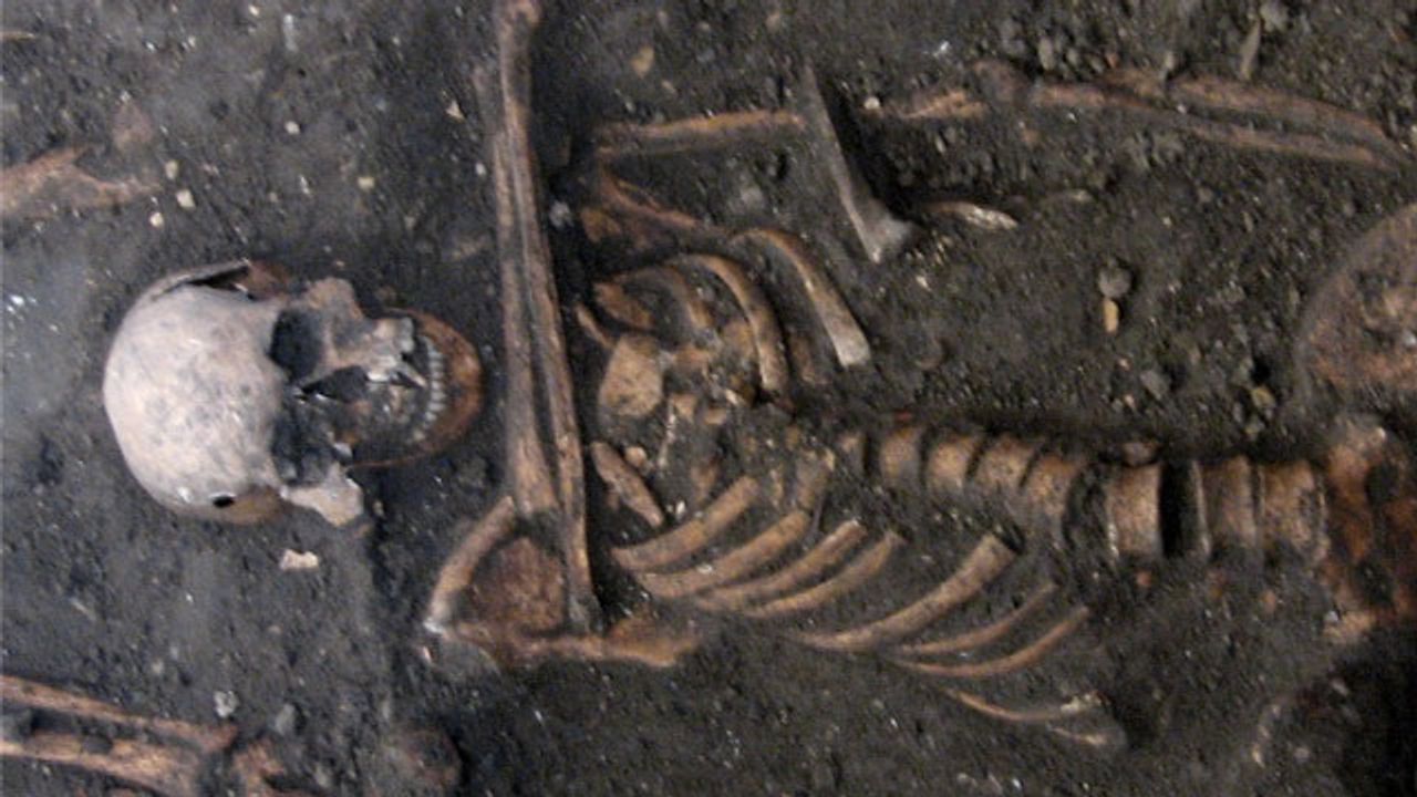 Cold Sore Virus Spread Traced Back to Bronze Age Kissing