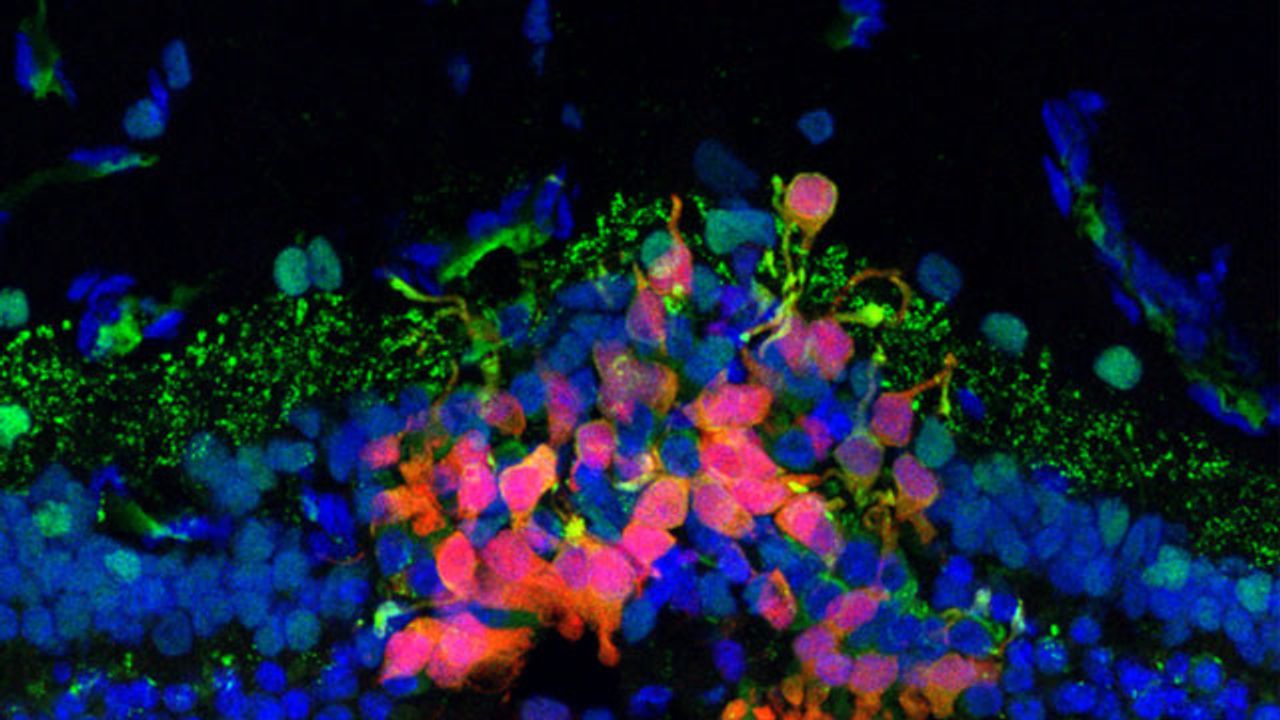 Immunosuppressive Cocktail Helps Advance Stem Cells for Blindness