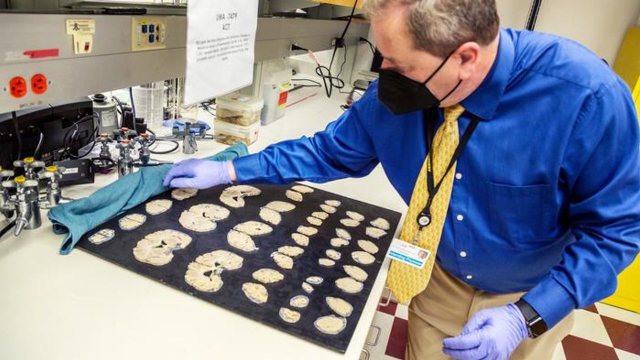 Cell-Level Map Builds an Atlas of Alzheimer's Brain Changes