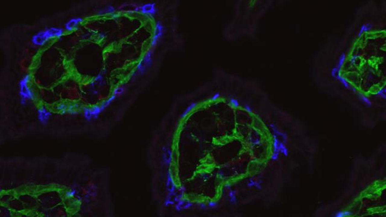 What Drives T Cells To Guard the Intestines?