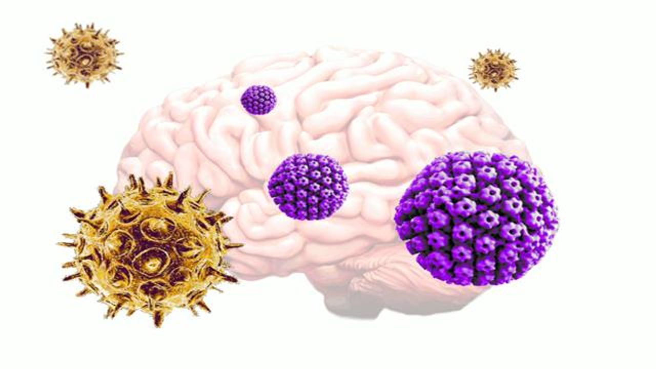 Common Viruses Could Be Triggering Alzheimer’s Disease Onset