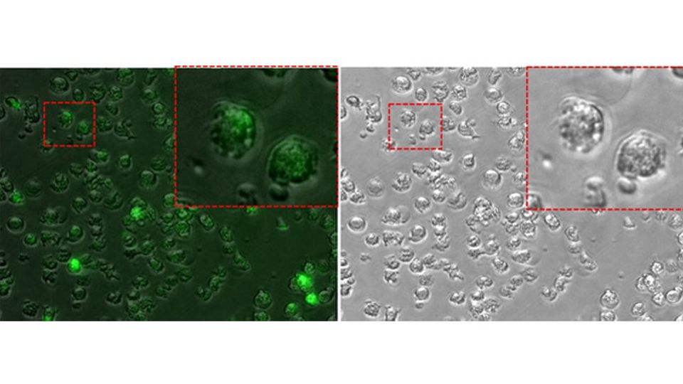 Weak Spot in Leukemia Cell Death Pathways Could Lead to New Therapies content piece image