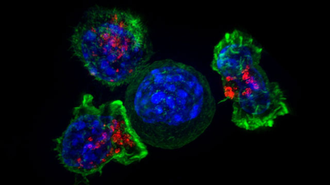 Targeted Immunotherapy Developed for Direct Injection Into Tumors