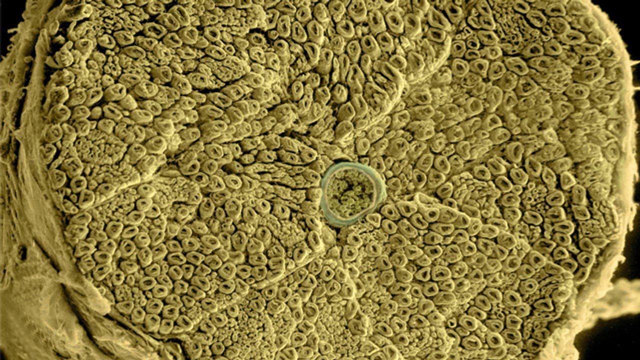 Human Spinal Nerve