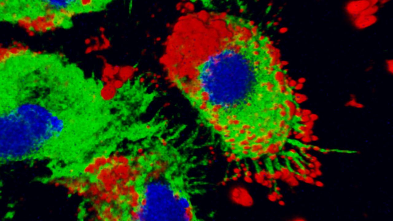 Experimental Drug Reduces Death From Aneurysm Rupture in Mice