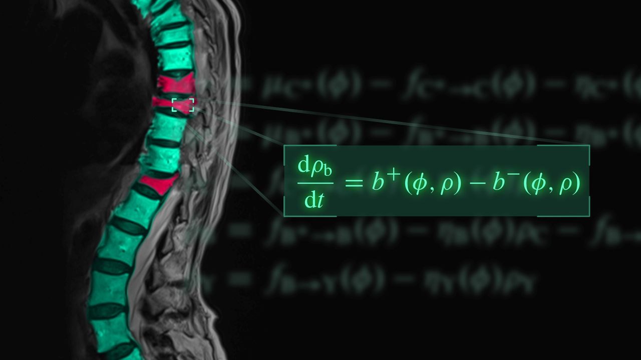 Mathematical Model Predicts Best Drug Combinations for Osteoporosis