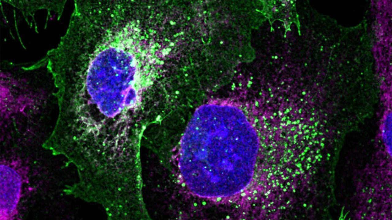 Patient-Derived Podocyte Kidney Cells