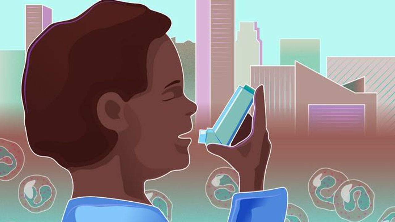 Monoclonal Antibody Decreased Asthma Attacks in Urban Youth