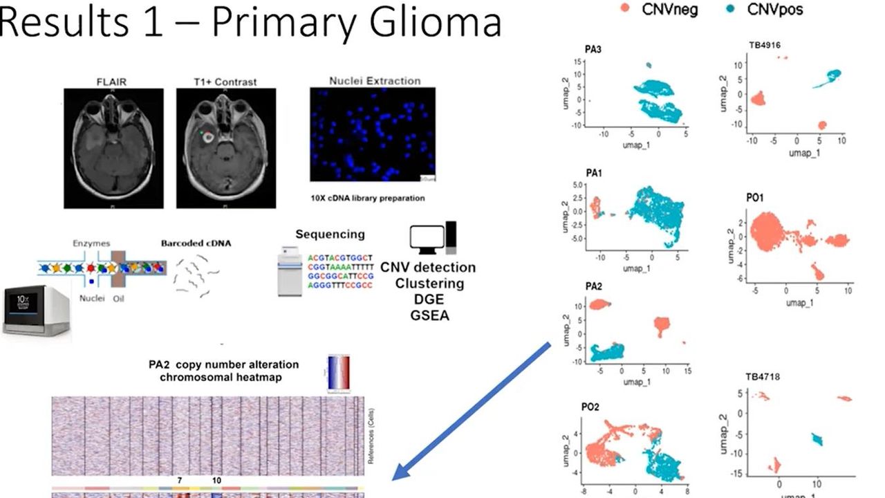 Re-Convolving the Compositional Landscape of Primary and Recurrent Glioblastoma Reveals Prognostic and Targetable Tissue States