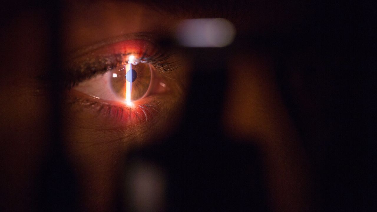 Curing Corneal Blindness With Bioengineered Pig Skin Implants