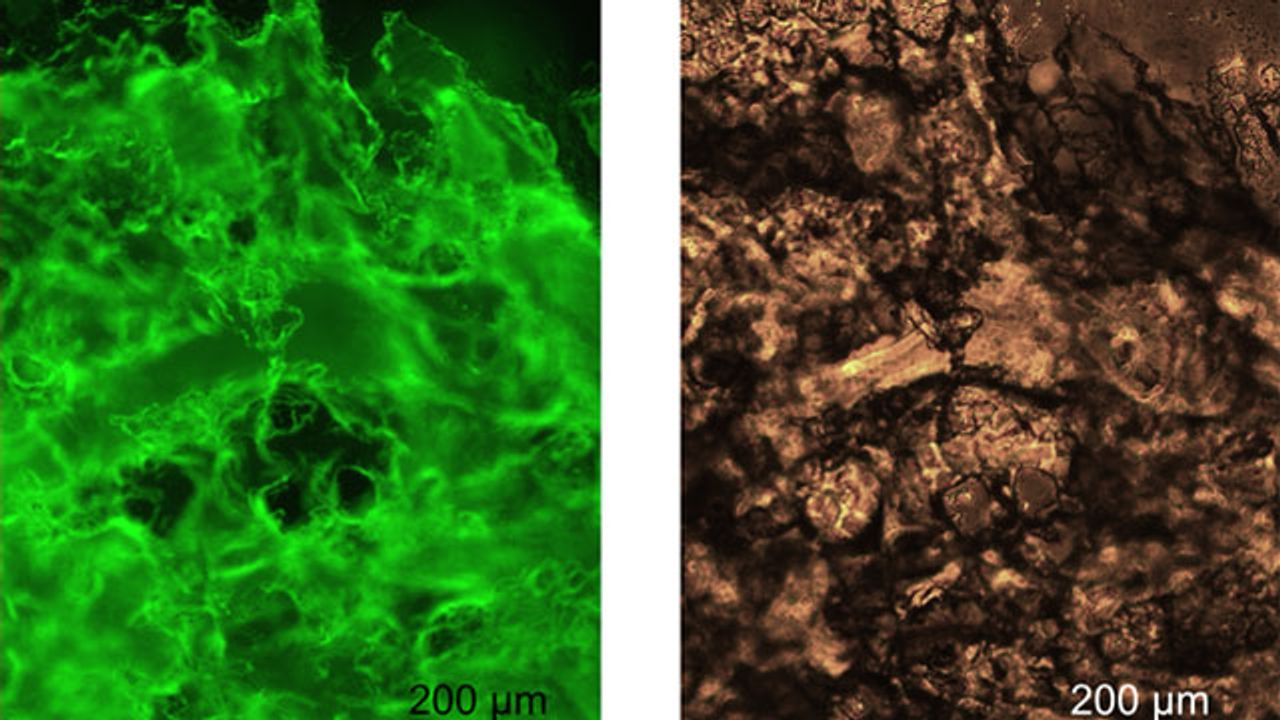 Injectable Gel Made From Spider Silk Shows Promise for Medical Use