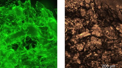 Injectable Gel Made From Spider Silk Shows Promise for Medical Use