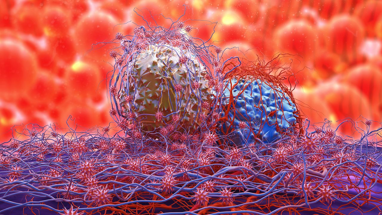 New Chip Could Lead to Targeted and Earlier Treatments for Metastatic Cancer