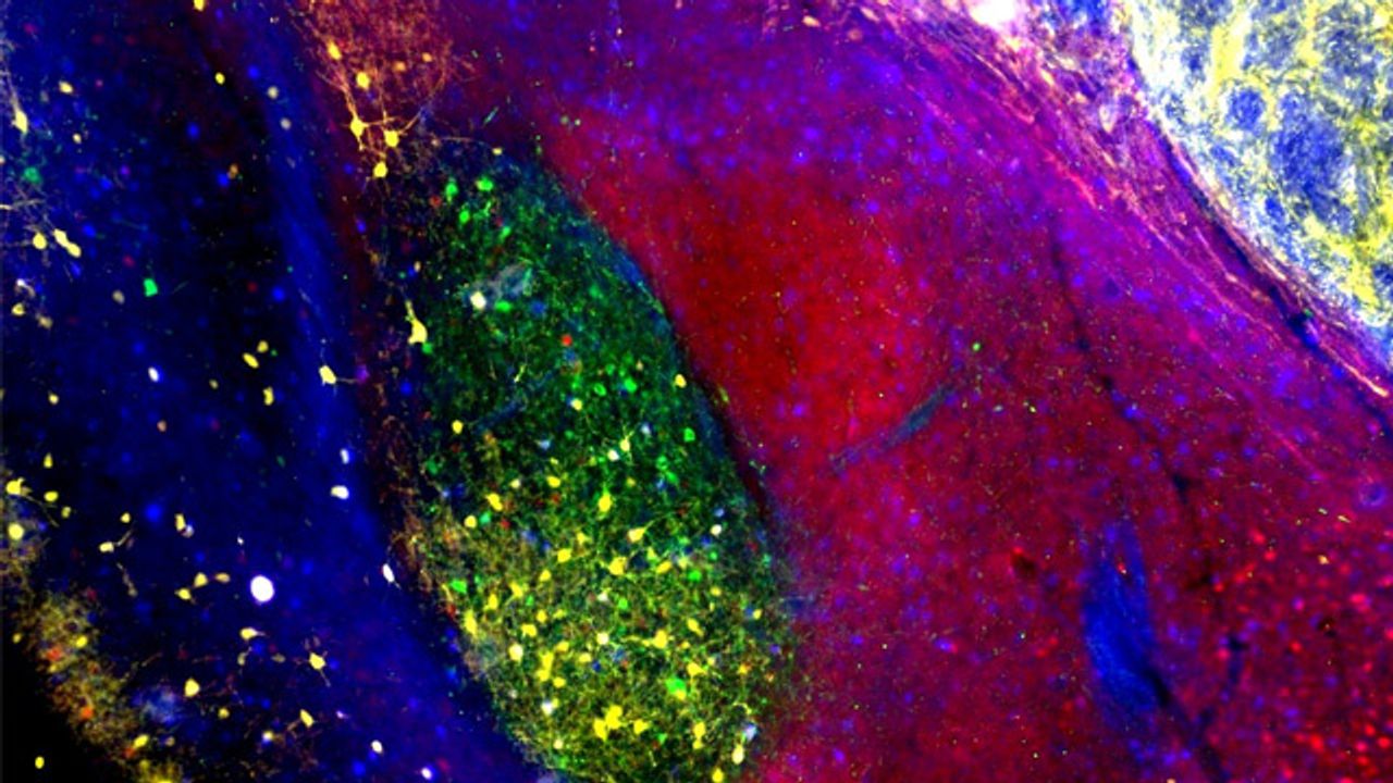 Sky of the Brain