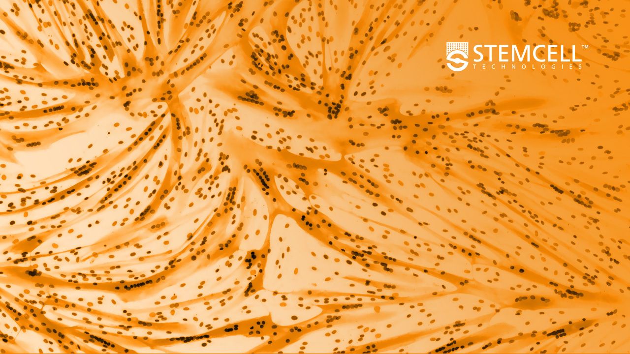 From Academia to Industry: Taking iPSC-Derived Muscle Cells to the Clinic