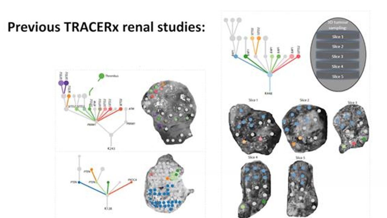 Selection of Metastasis Competent Subclones in the Tumor Interior