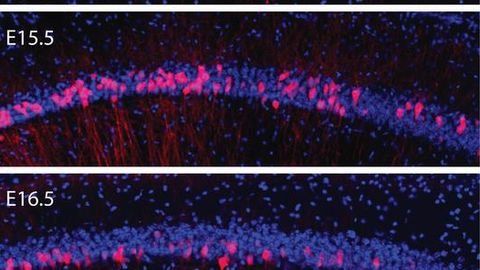 Brain Cells Born Together Wire Together for Life
