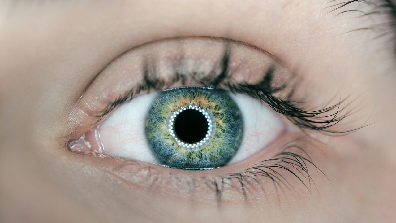 Gene Therapy Partly Restores Cone Receptors in Children Born Completely Colorblind