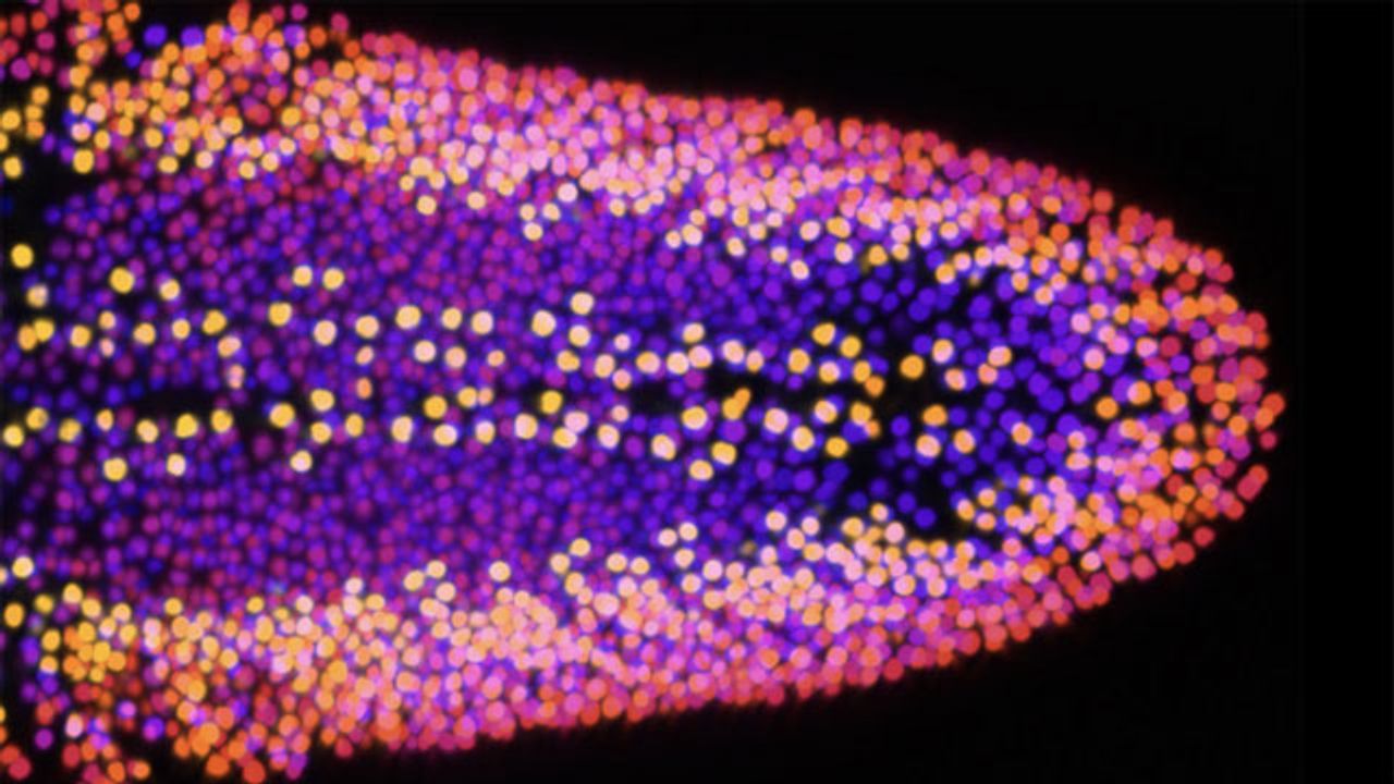 Dementia Link to Protein "Traffic Jams" Identified