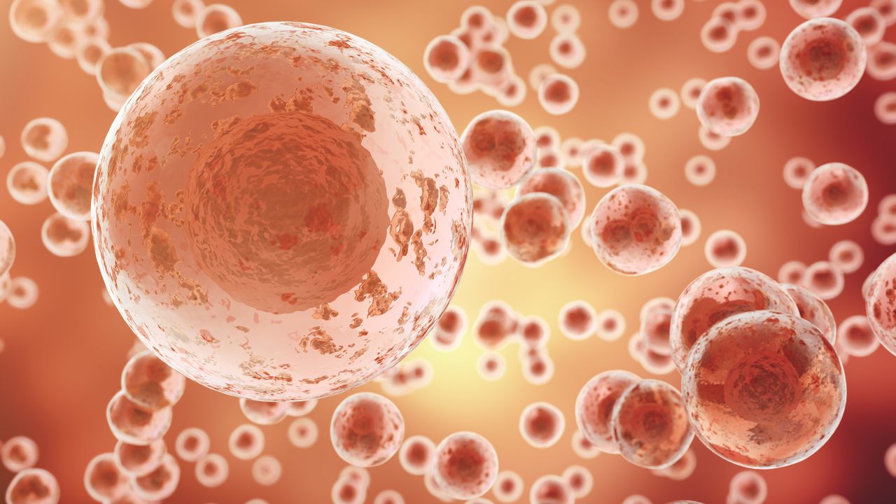 Accumulation of Nucleus Protein Fascin in Cancer Cells May Halt Their Spread