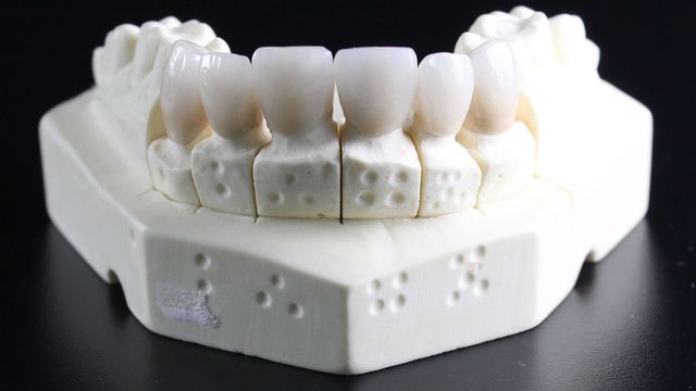 "Positive Stress" Can Make Tooth Stem Cells More Resistant to Disease content piece image 