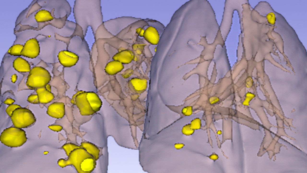 Drug Combination Halts Tumor Growth and Resistance in Mice