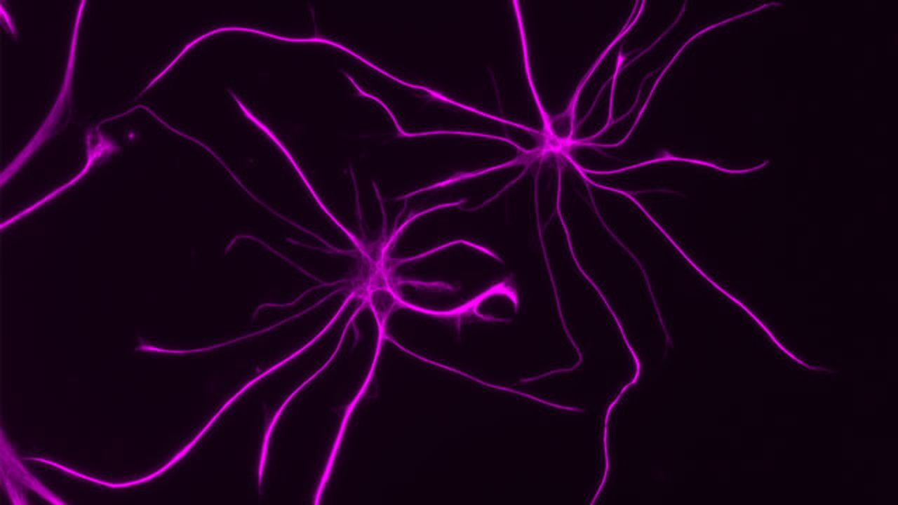 Astrocyte Study Goes Beyond the Neuron To Understand Brain Disorders