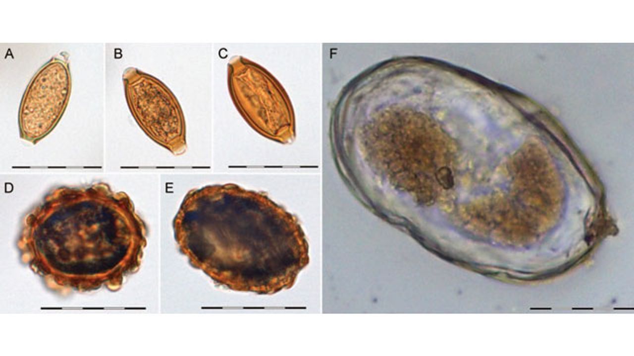 Viking Poop DNA Reveals New Insights on Relationship With Gut Companions