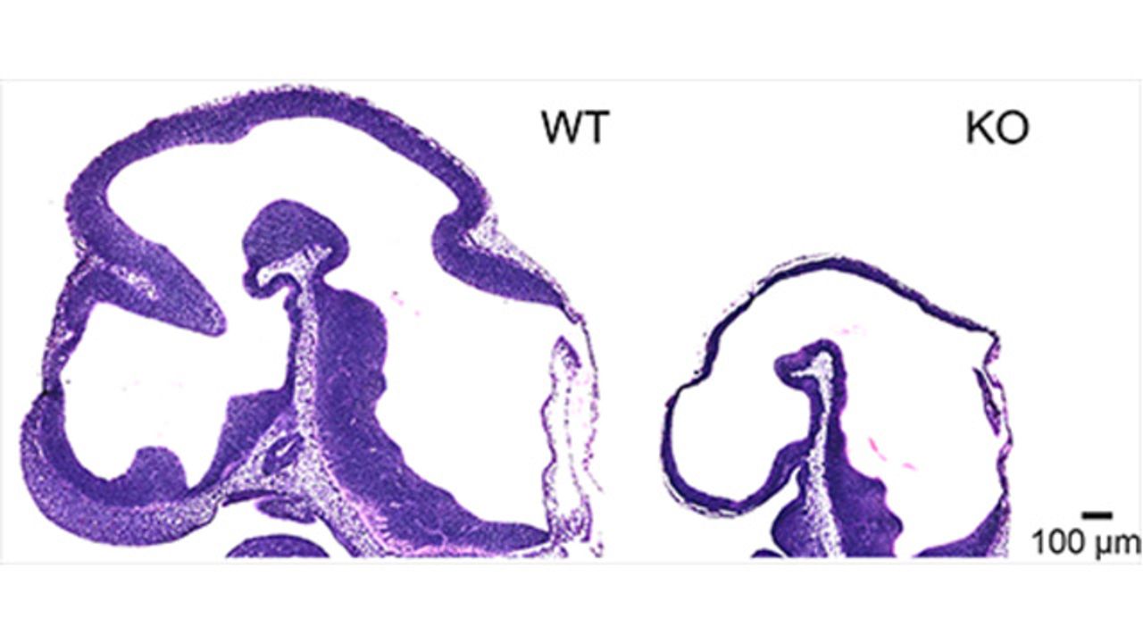 Sensor Proteins and Cholesterol Linked During Brain Development