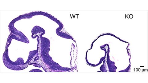 Sensor Proteins and Cholesterol Linked During Brain Development