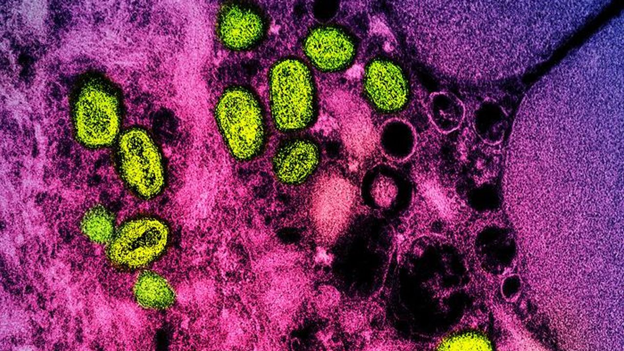Monkeypox Vaccine Clinical Trial Begins