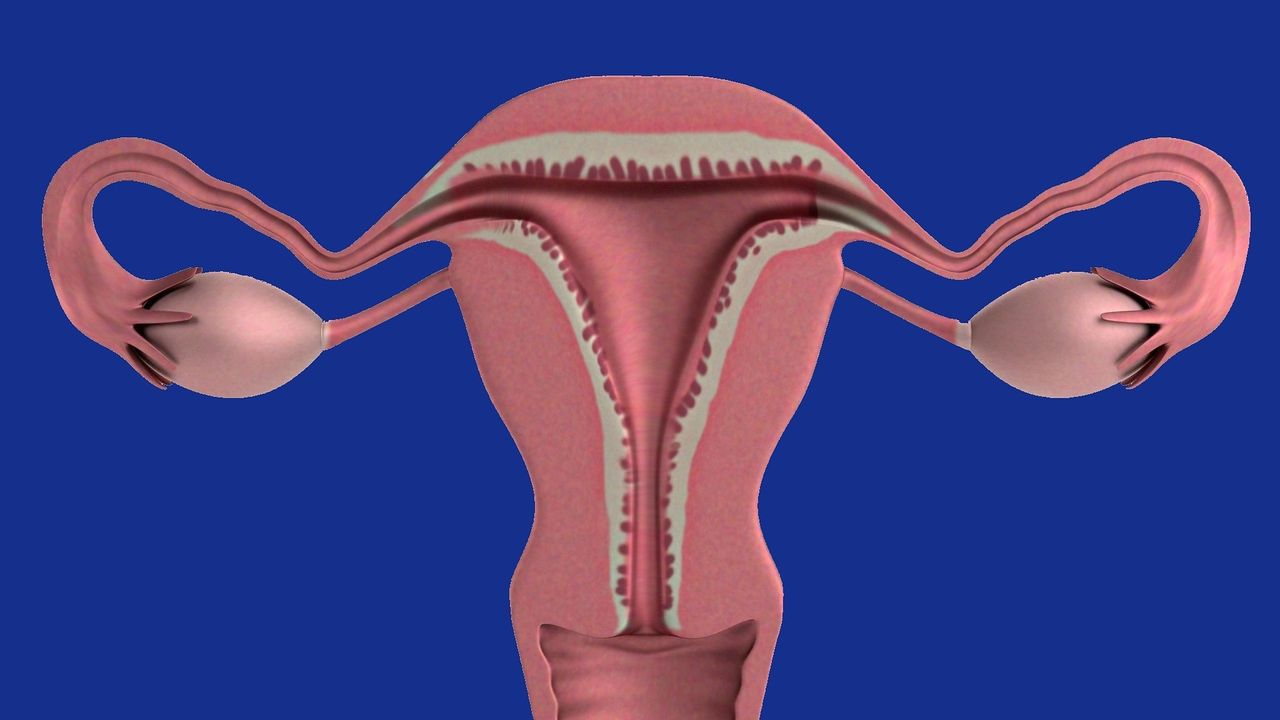 Ovarian Cancer Detection Takes a Step Forward