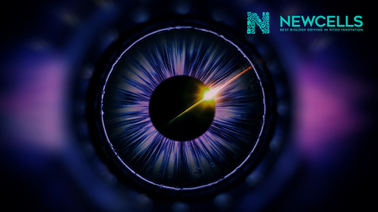 Generation and Characterization of Retinal Organoids From iPSCs