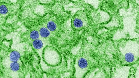 How Zika Virus Manipulates Immune Cells Into Becoming Virus Factories