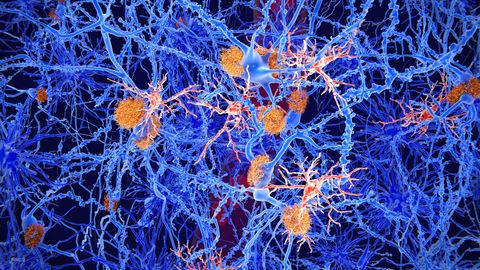 Microglial Genes Are Altered by Fear Conditioning