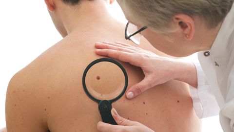 Trial of Immunotherapy Before Skin Cancer Surgery Induced Complete Response in Over Half of Patients