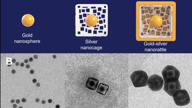 Nanorattles准确地识别头部和颈部癌症内容块的形象