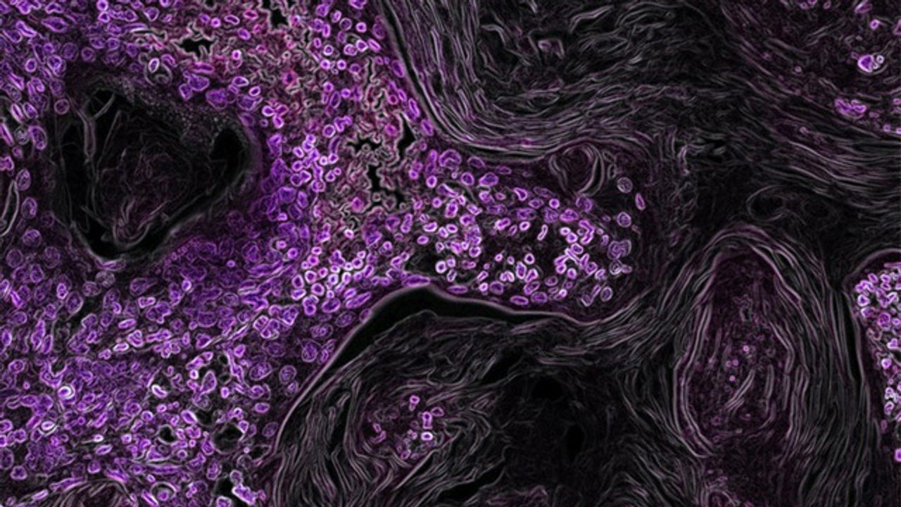 New Drug Can Flag Cancer Cells for Immune Destruction