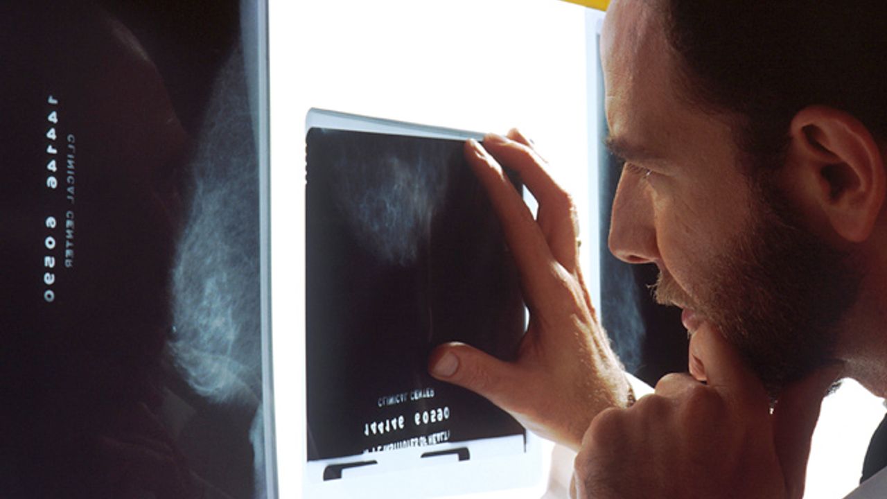 Imaging Technique Developed in Mice Could Improve Breast Cancer Detection