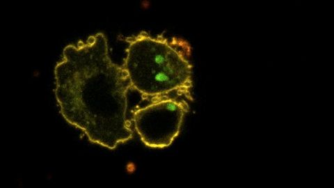 How Circadian Clock Dysfunction Can Lead to Lipid Profile Disruption