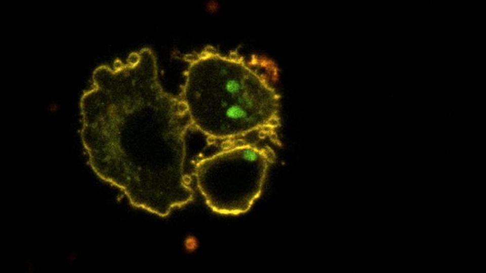 How Circadian Clock Dysfunction Can Lead to Lipid Profile Disruption content piece image